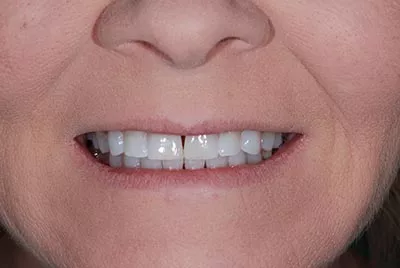 Before image