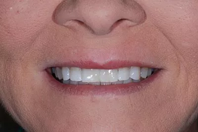 After image