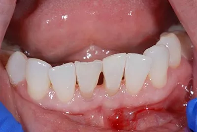 Before image
