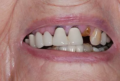 Before image