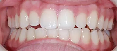 After image