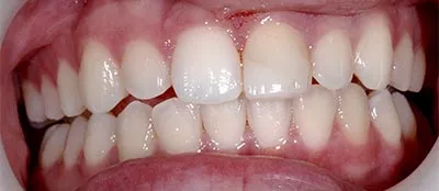 Before image