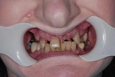 Before image