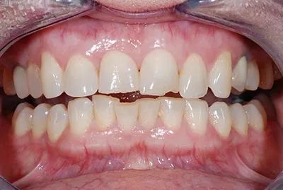 Before image