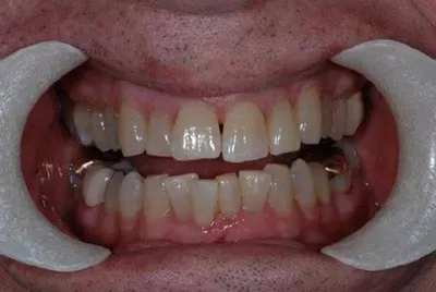 Before image