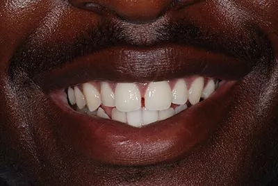 Before image