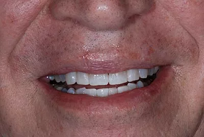 After image