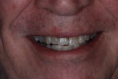 Before image