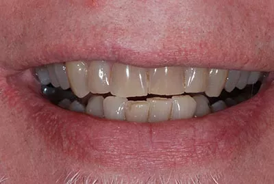 Before image