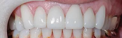 After image