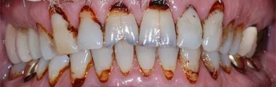 Before image