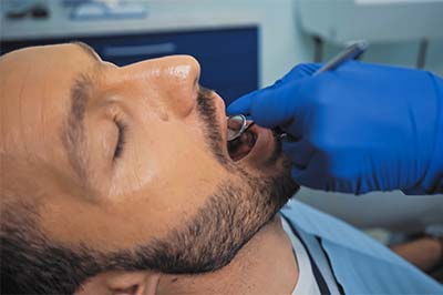 man asleep during dental procedure with the help of sedation