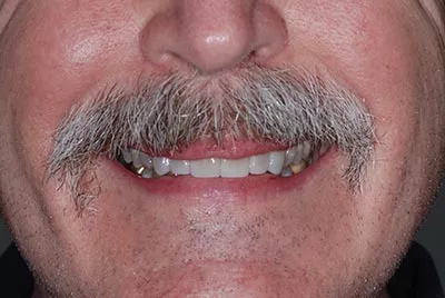 After image