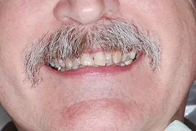 Before image