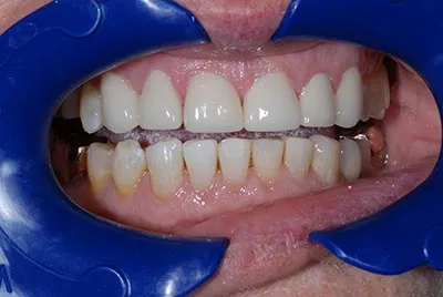 After image