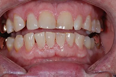 Before image