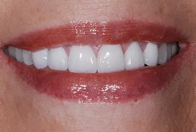 After image