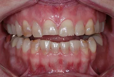 Before image