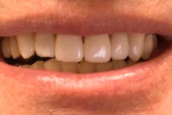 After image