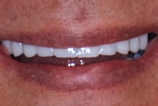 After image