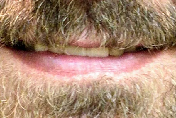 After image