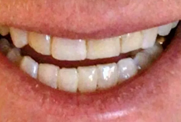 After image