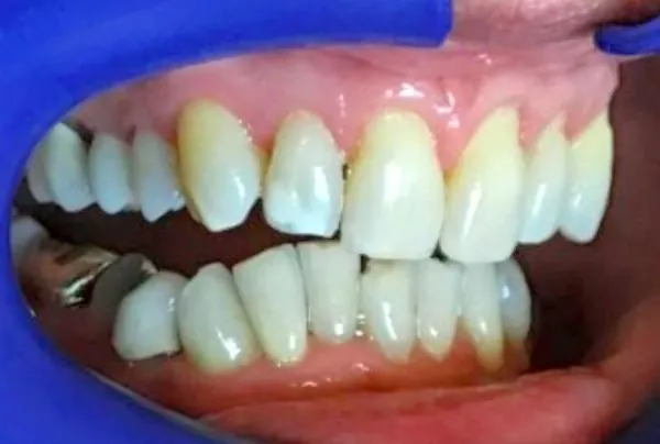 Before image