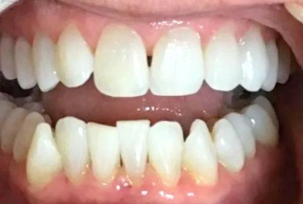 Before image