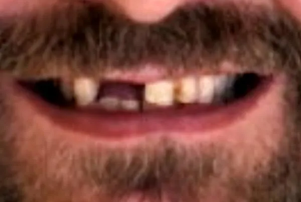 Before image