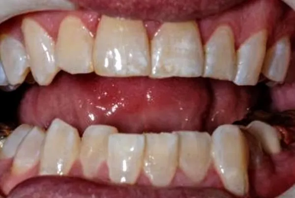 Before image