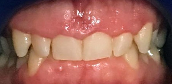 Before image