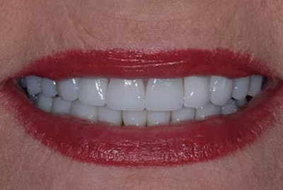 After image