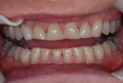 Before image