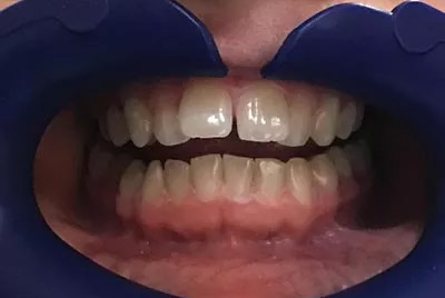 Before image