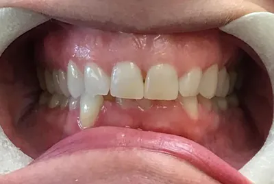 Before image