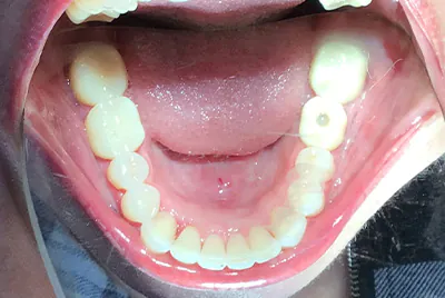 After image
