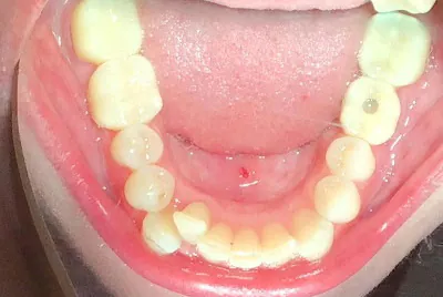 Before image