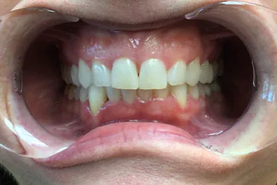 Before image