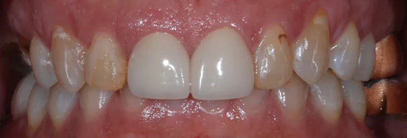 Before image